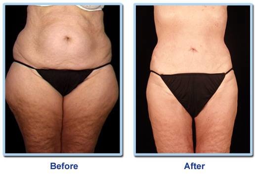 Dr Mohamed Yehia Khalil, Consultant of plastic surgery- Hurghada - Dr Mohamed Yehia Khalil, Consultant of plastic surgery- Hurghada