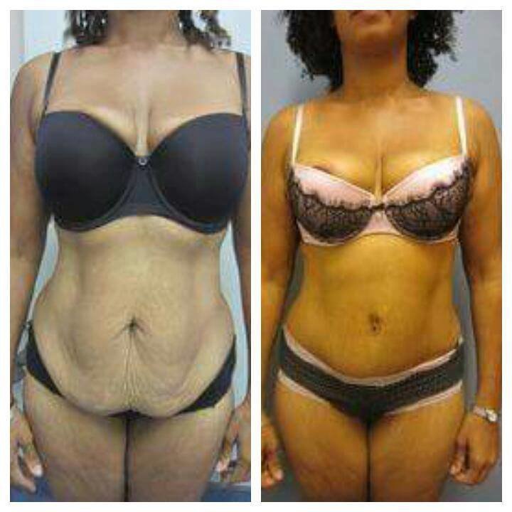 Dr Mohamed Yehia Khalil, Consultant of plastic surgery- Hurghada - Dr Mohamed Yehia Khalil, Consultant of plastic surgery- Hurghada