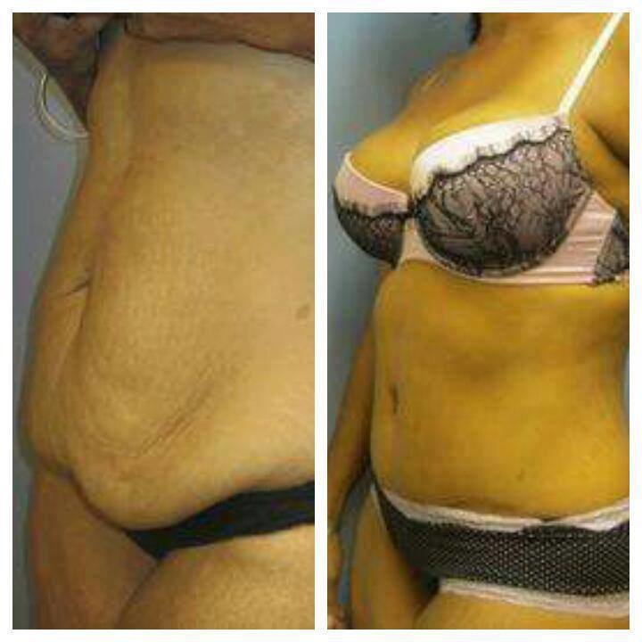 Dr Mohamed Yehia Khalil, Consultant of plastic surgery- Hurghada - Dr Mohamed Yehia Khalil, Consultant of plastic surgery- Hurghada