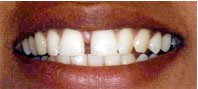 Dr. Mukul Dabholkar’s Dental Clinic - Dr. Mukul Dabholkar’s Dental Clinic