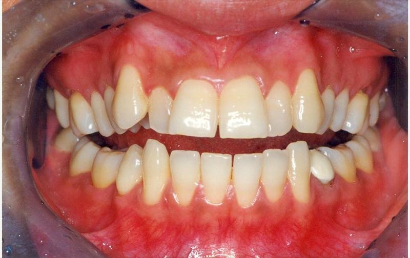 Dr. Mukul Dabholkar’s Dental Clinic - Dr. Mukul Dabholkar’s Dental Clinic