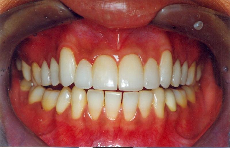 Dr. Mukul Dabholkar’s Dental Clinic - Dr. Mukul Dabholkar’s Dental Clinic