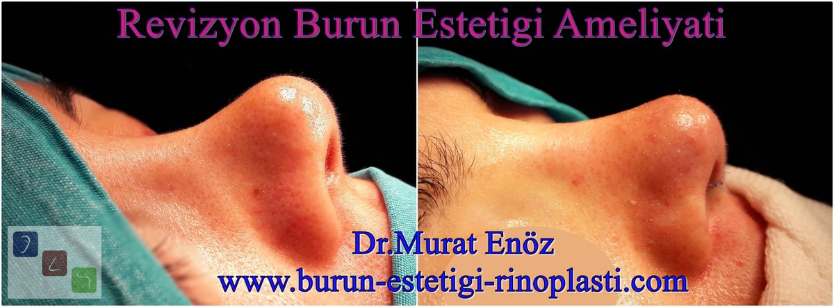 Dr Murat Enoz, ENT Specialist - Private Office - Dr Murat Enoz, ENT Specialist - Private Office