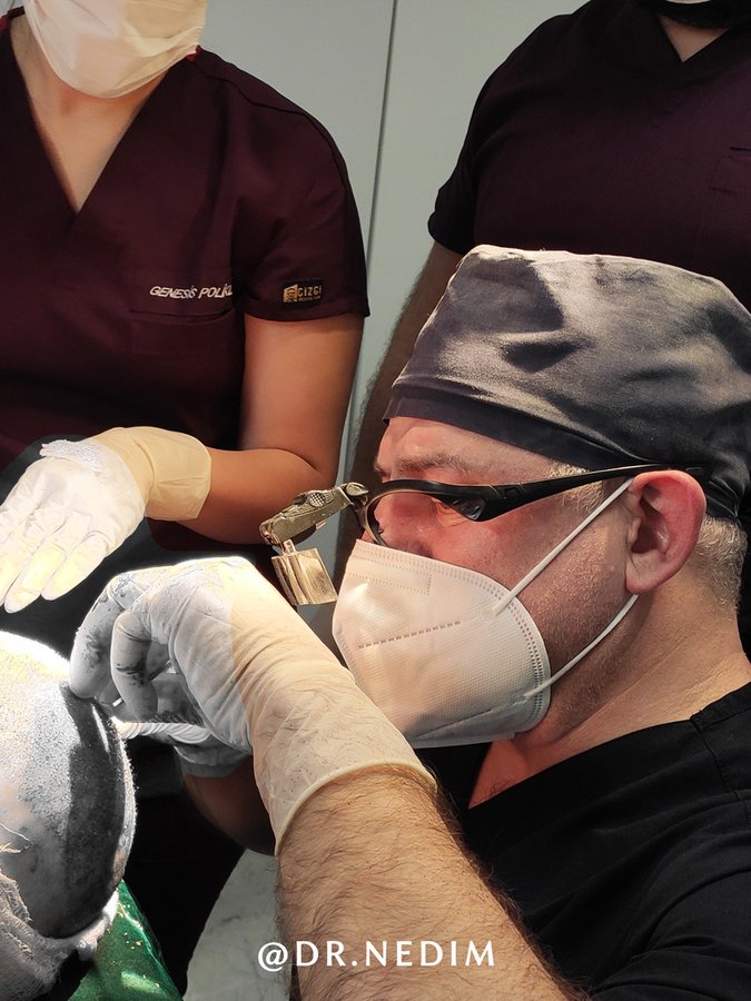 عيادة الدكتور نديم لزراعة الشعر - Dr Nedim Hair Transplant Clinic