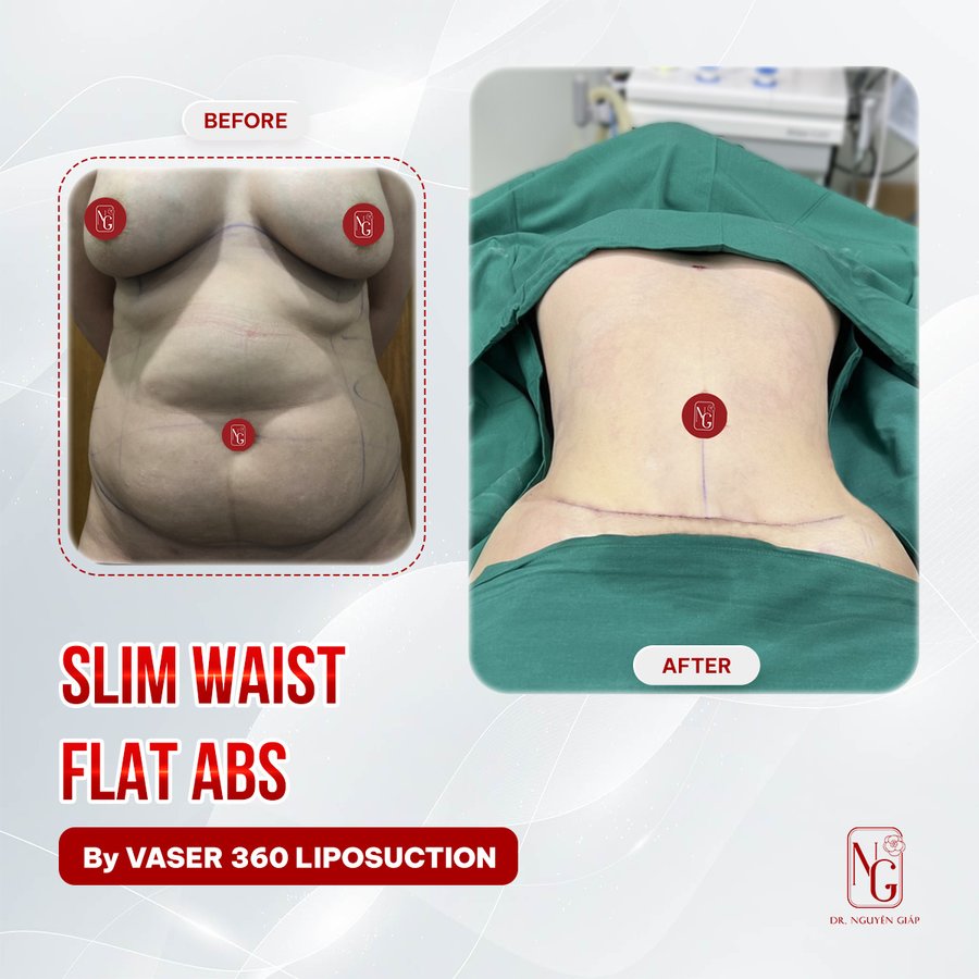 Dr Nguyen Giap Aesthetic Surgery Center