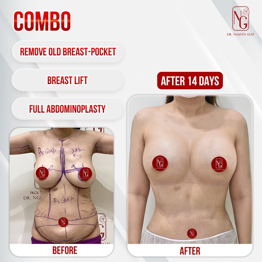 Dr Nguyen Giap Aesthetic Surgery Center - Dr Nguyen Giap Aesthetic Surgery Center