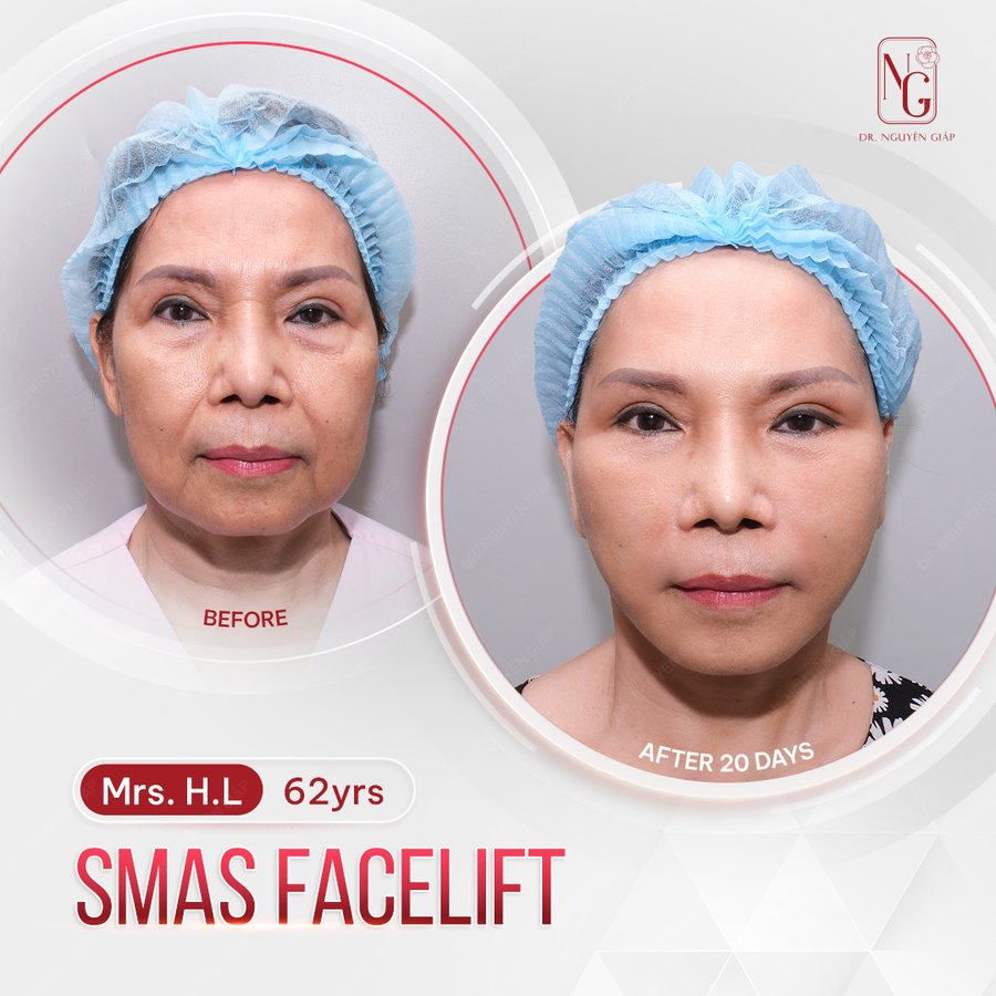 Dr Nguyen Giap Aesthetic Surgery Center - Dr Nguyen Giap Aesthetic Surgery Center