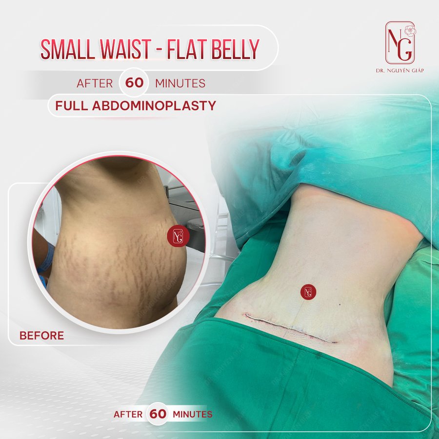 Dr Nguyen Giap Aesthetic Surgery Center - Dr Nguyen Giap Aesthetic Surgery Center