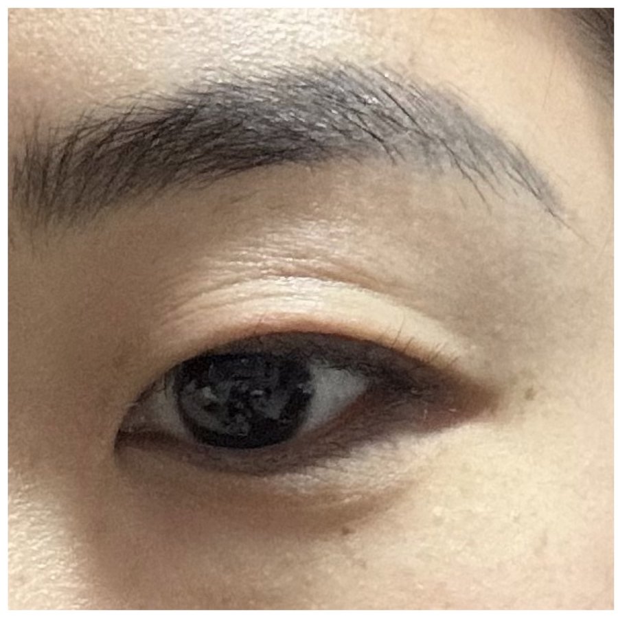 Dr Nguyen - Dr Nguyen