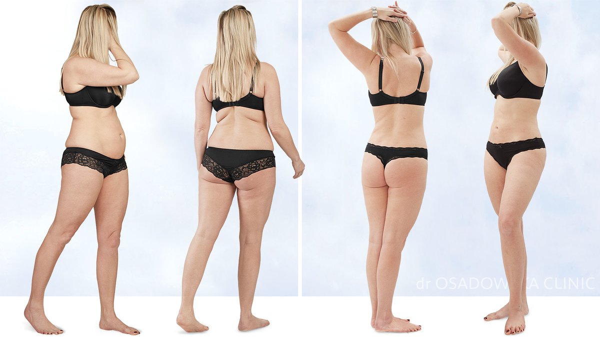 Dr Osadowska Clinic Szczecin - Dr Osadowska Clinic Szczecin