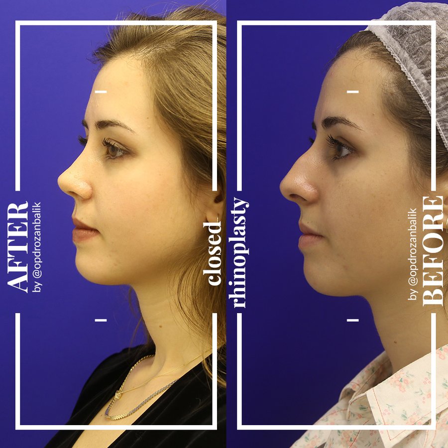 Dr Ozan Balik Clinic - Dr Ozan Balik Clinic