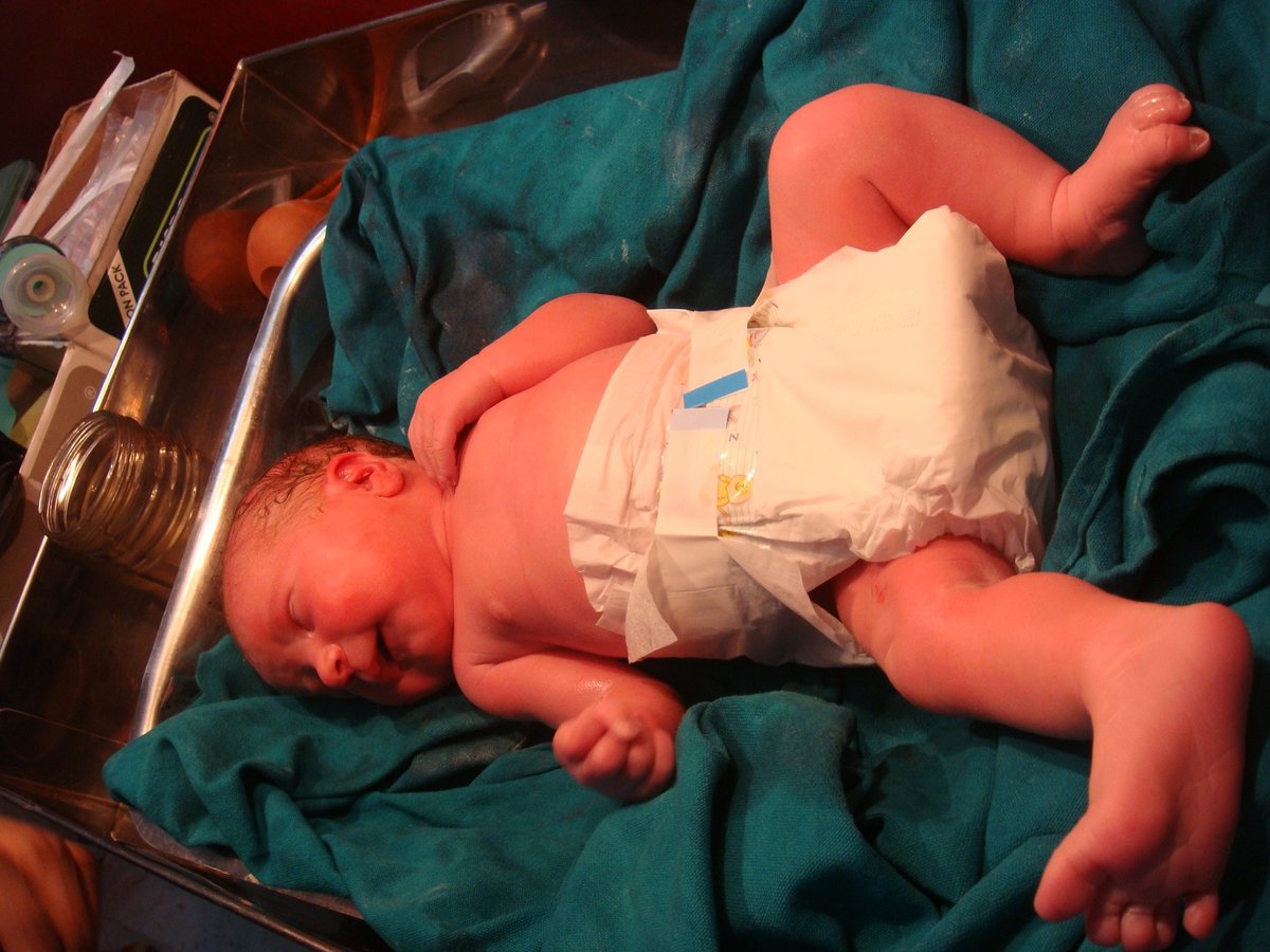 Dr Padmaja Fertility Centre, Hyderabad - Dr Padmaja Fertility Centre, Hyderabad