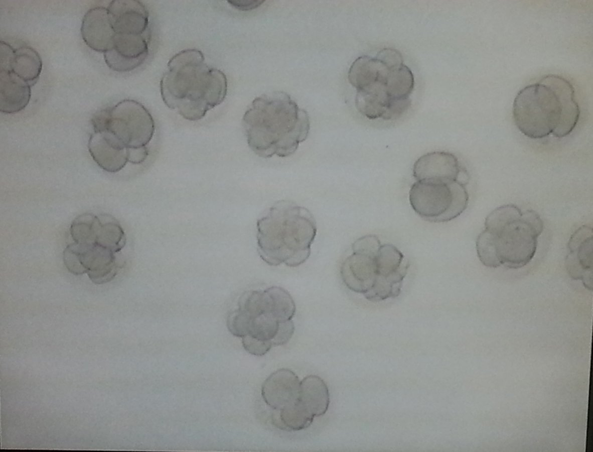 Dr Padmaja Fertility Centre, Hyderabad - Dr Padmaja Fertility Centre, Hyderabad