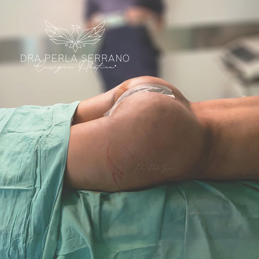 الدكتور بيرلا سيرانو - Dr. Perla Serrano
