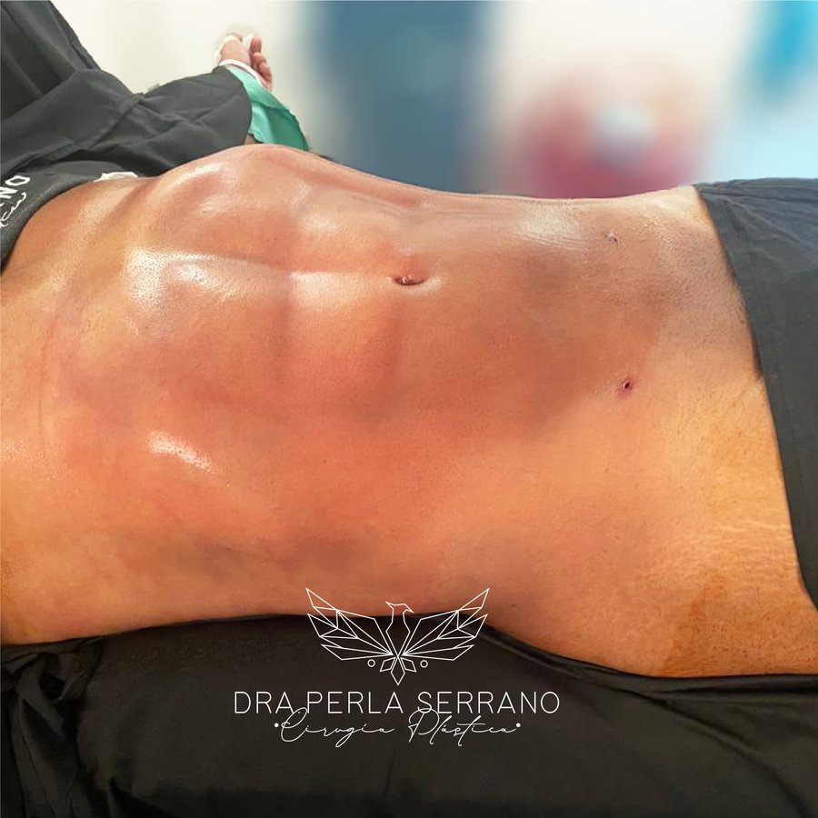 الدكتور بيرلا سيرانو - Dr. Perla Serrano