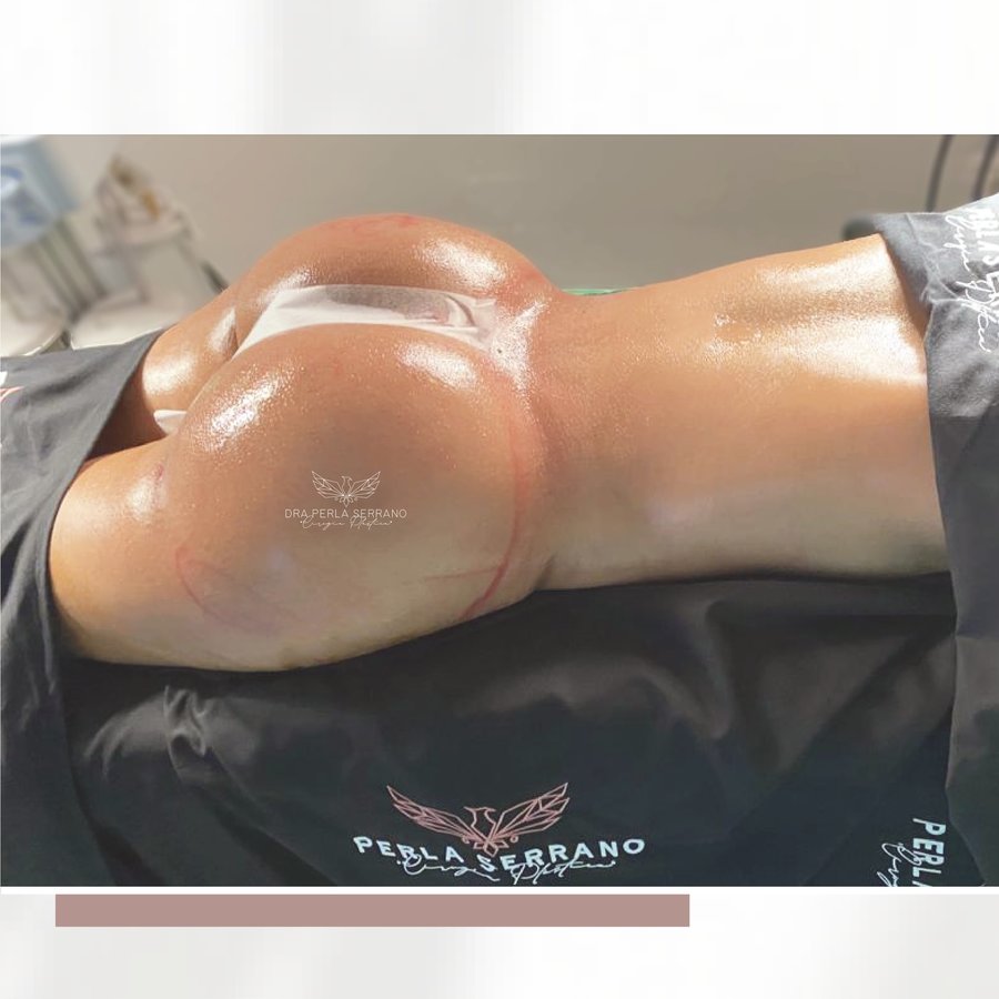 الدكتور بيرلا سيرانو - Dr. Perla Serrano