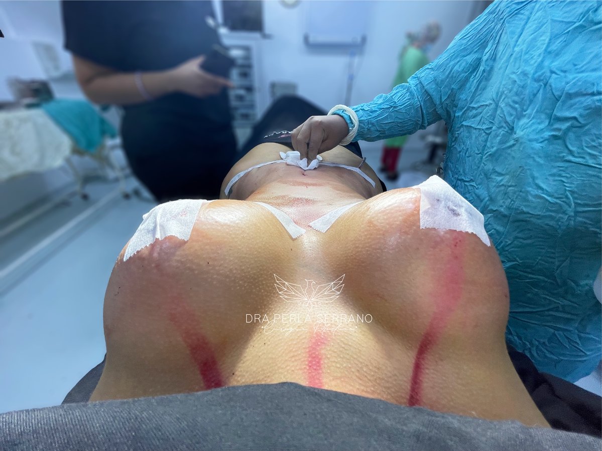 الدكتور بيرلا سيرانو - Dr. Perla Serrano