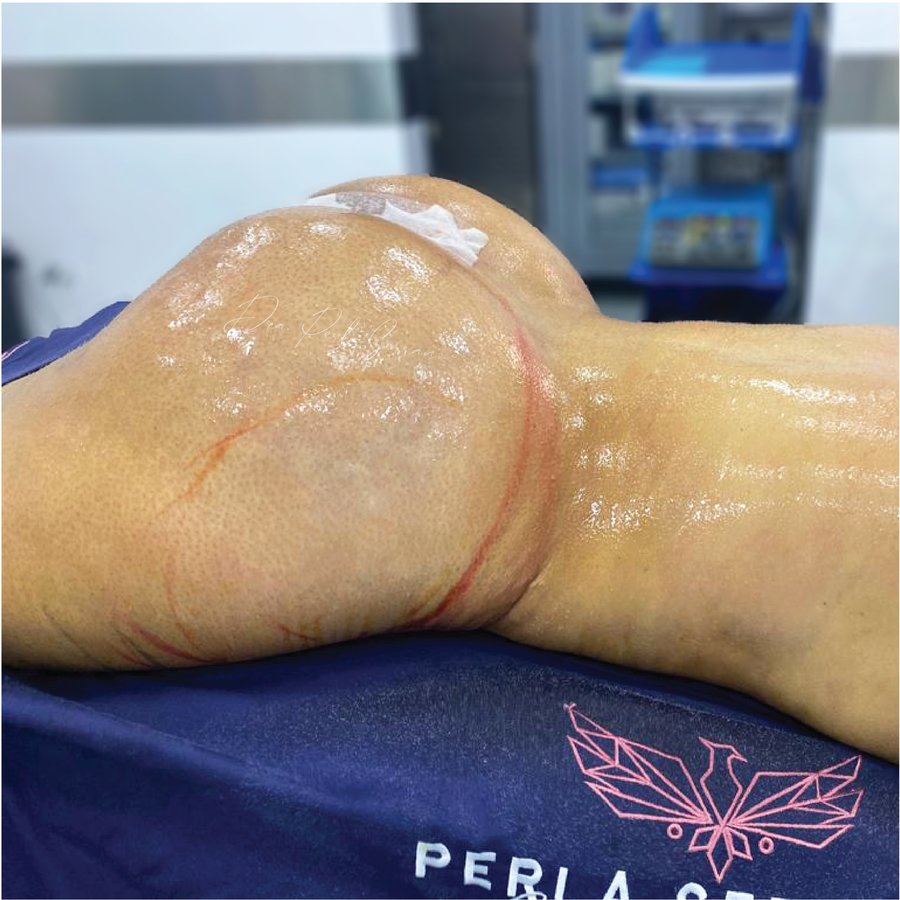 الدكتور بيرلا سيرانو - Dr. Perla Serrano