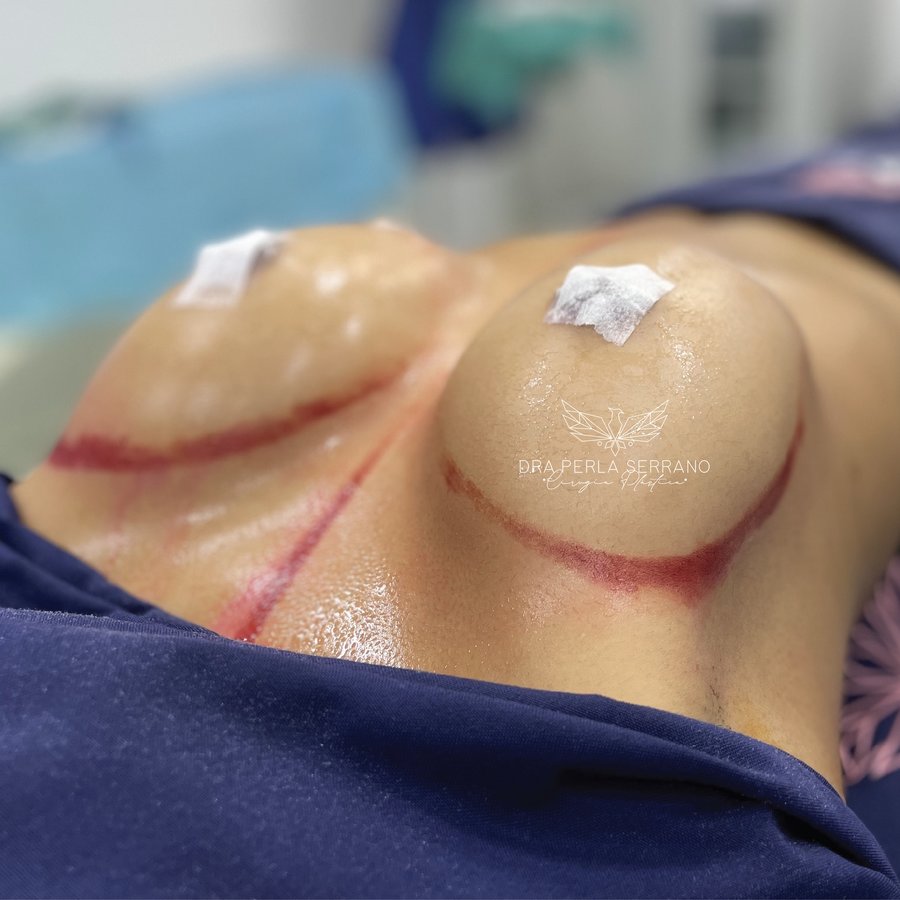 الدكتور بيرلا سيرانو - Dr. Perla Serrano