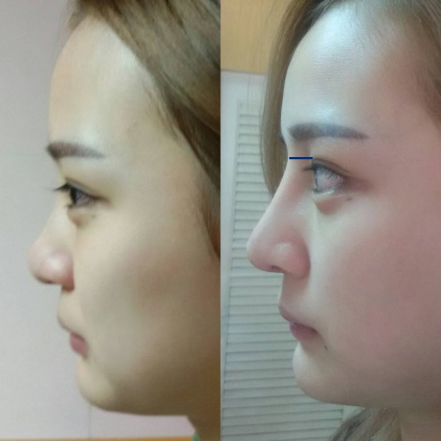 Dr. Prinya Plastic surgery and liposuction center-Hatyai - Dr. Prinya Plastic surgery and liposuction center-Hatyai