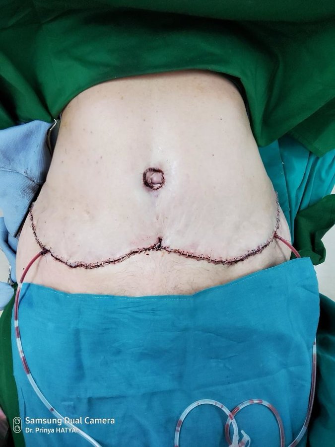 Dr. Prinya Plastic surgery and liposuction center-Hatyai - Dr. Prinya Plastic surgery and liposuction center-Hatyai