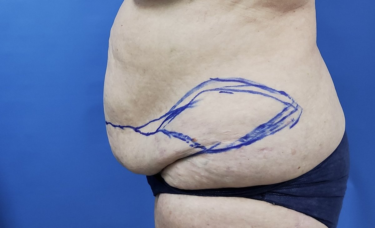 Dr. Prinya Plastic surgery and liposuction center-Hatyai - Dr. Prinya Plastic surgery and liposuction center-Hatyai