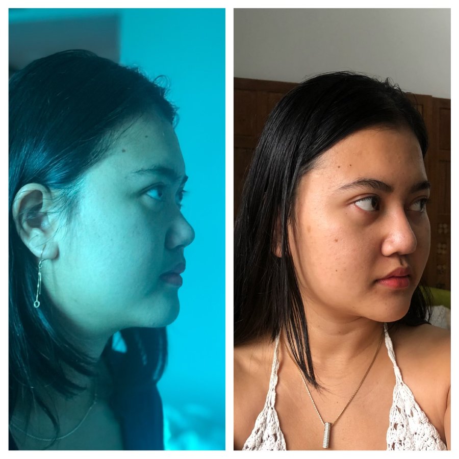 Dr. Prinya Plastic surgery and liposuction center-Hatyai - Dr. Prinya Plastic surgery and liposuction center-Hatyai