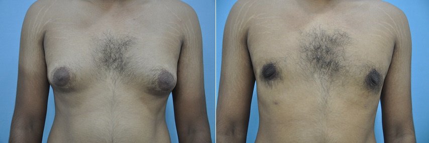 Dr. R. K. Mishra- Plastic & Cosmetic Surgeon -SIPS - Dr. R. K. Mishra- Plastic & Cosmetic Surgeon -SIPS