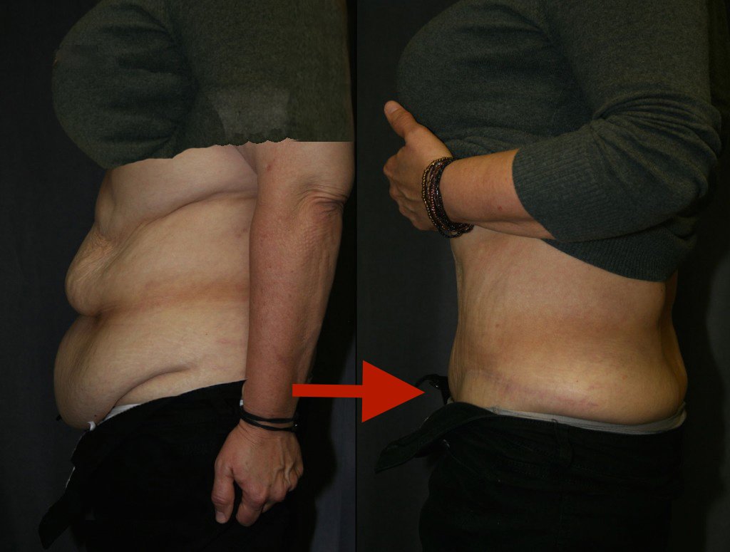 Dr. R. K. Mishra- Plastic & Cosmetic Surgeon -SIPS - Dr. R. K. Mishra- Plastic & Cosmetic Surgeon -SIPS