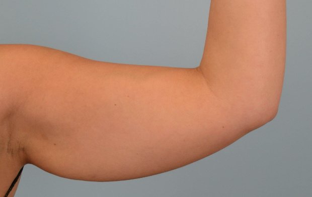 Dr. R. K. Mishra- Plastic & Cosmetic Surgeon -SIPS - Dr. R. K. Mishra- Plastic & Cosmetic Surgeon -SIPS