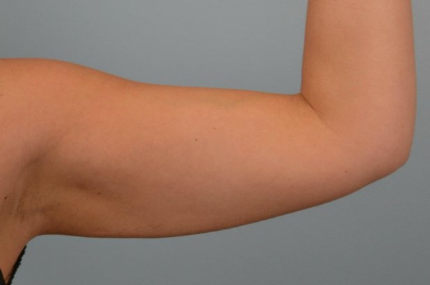 Dr. R. K. Mishra- Plastic & Cosmetic Surgeon -SIPS - Dr. R. K. Mishra- Plastic & Cosmetic Surgeon -SIPS