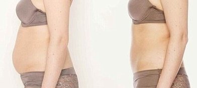 Dr. R. K. Mishra- Plastic & Cosmetic Surgeon -SIPS - Dr. R. K. Mishra- Plastic & Cosmetic Surgeon -SIPS