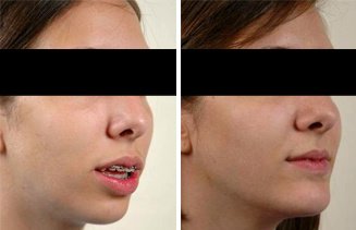 Dr. R. K. Mishra- Plastic & Cosmetic Surgeon -SIPS - Dr. R. K. Mishra- Plastic & Cosmetic Surgeon -SIPS