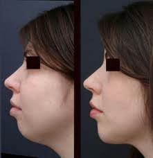 Dr. R. K. Mishra- Plastic & Cosmetic Surgeon -SIPS - Dr. R. K. Mishra- Plastic & Cosmetic Surgeon -SIPS