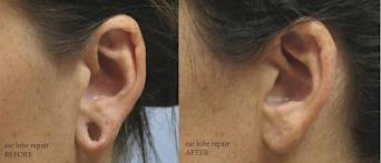 Dr. R. K. Mishra- Plastic & Cosmetic Surgeon -SIPS - Dr. R. K. Mishra- Plastic & Cosmetic Surgeon -SIPS