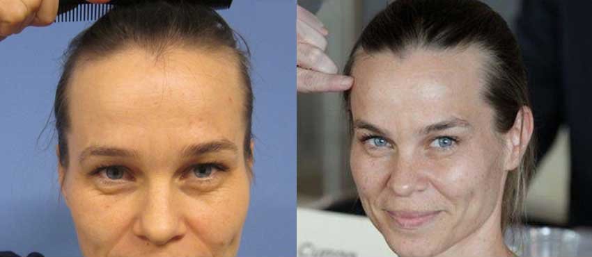 Dr. Rafeek’s Skin & Cosmetic Center - Calicut - Dr. Rafeek’s Skin & Cosmetic Center - Calicut