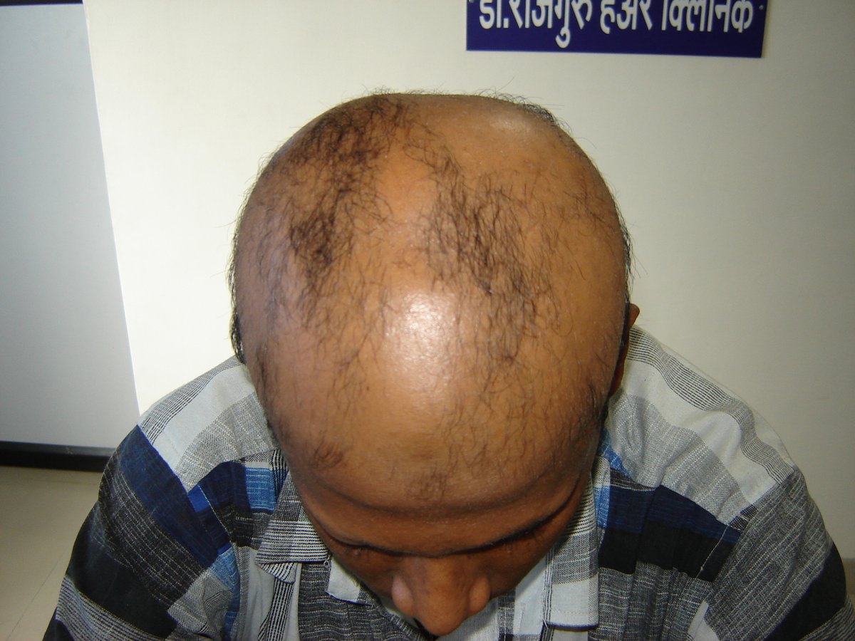 عيادة الدكتور راجغورو للعناية بالشعر - Dr. Rajguru Hair Care&Research Clinic