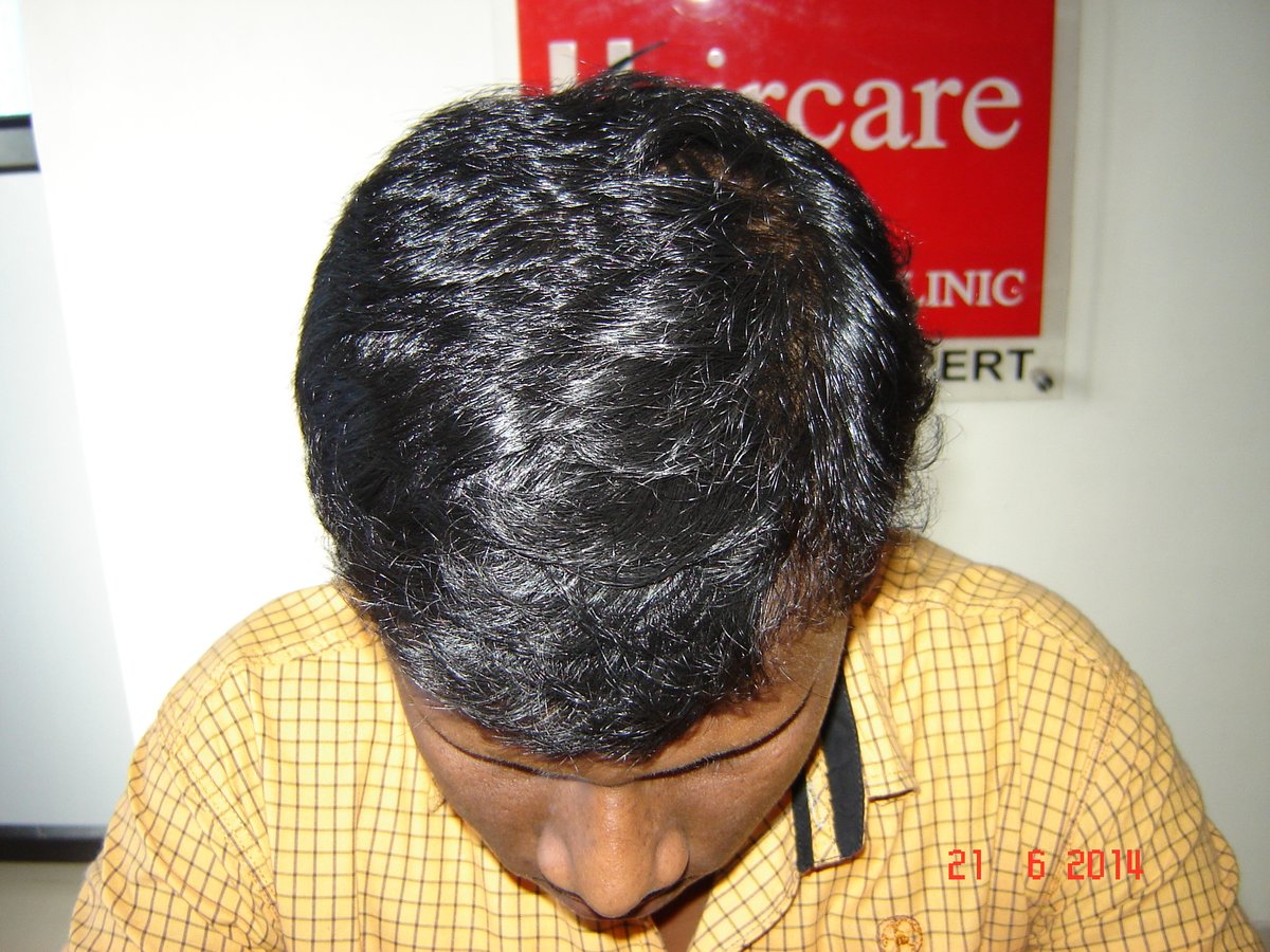 عيادة الدكتور راجغورو للعناية بالشعر - Dr. Rajguru Hair Care&Research Clinic