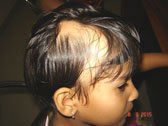 عيادة الدكتور راجغورو للعناية بالشعر - Dr. Rajguru Hair Care&Research Clinic