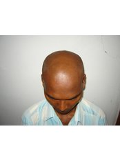 عيادة الدكتور راجغورو للعناية بالشعر - Dr. Rajguru Hair Care&Research Clinic