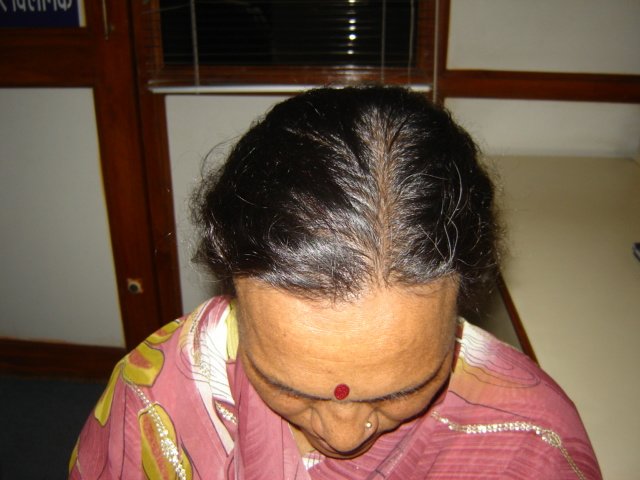 عيادة الدكتور راجغورو للعناية بالشعر - Dr. Rajguru Hair Care&Research Clinic