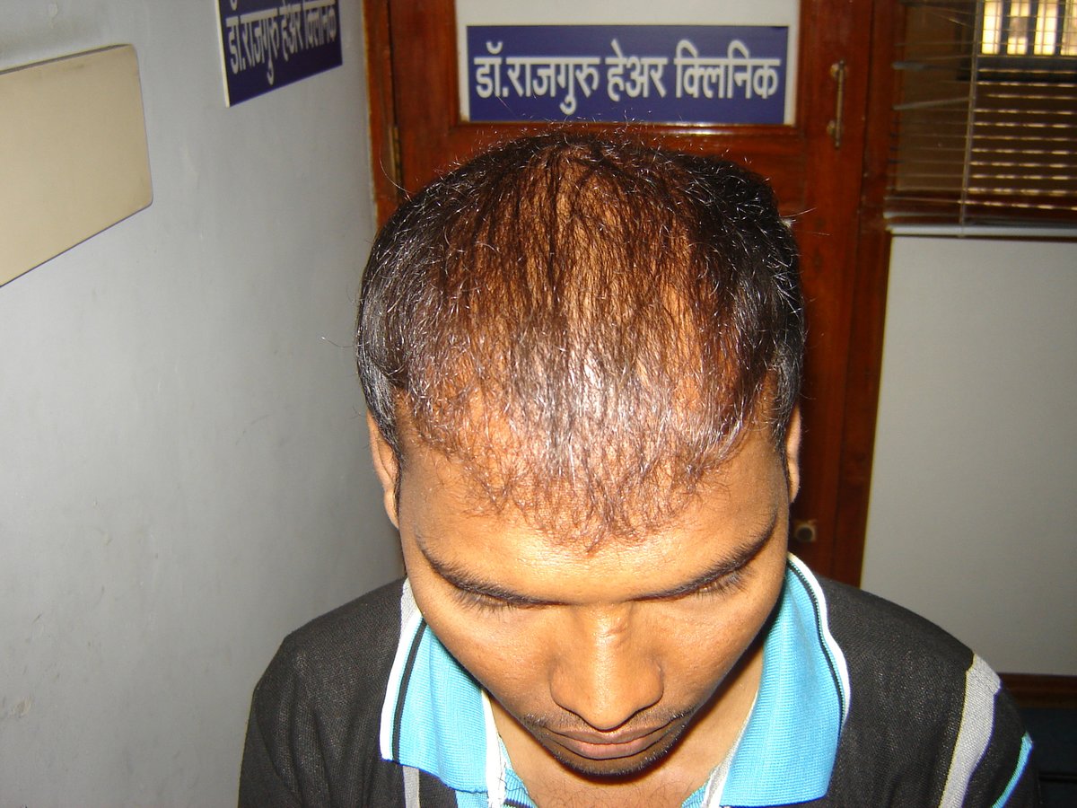 عيادة الدكتور راجغورو للعناية بالشعر - Dr. Rajguru Hair Care&Research Clinic