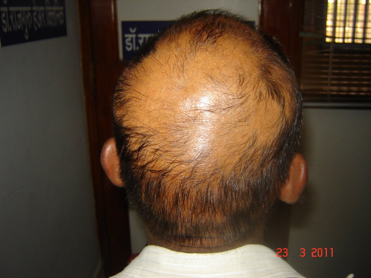 عيادة الدكتور راجغورو للعناية بالشعر - Dr. Rajguru Hair Care&Research Clinic