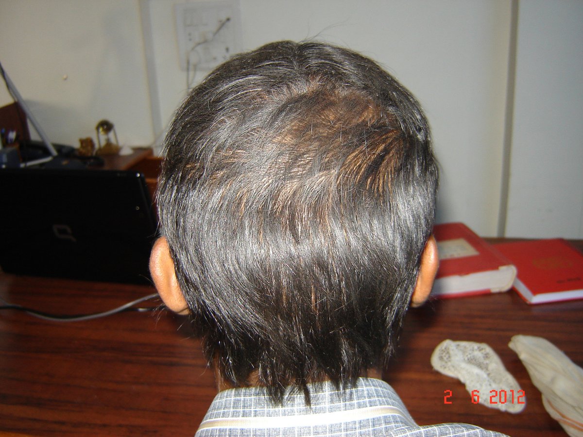 عيادة الدكتور راجغورو للعناية بالشعر - Dr. Rajguru Hair Care&Research Clinic
