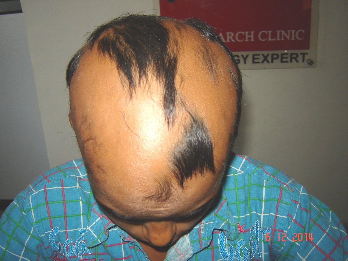 عيادة الدكتور راجغورو للعناية بالشعر - Dr. Rajguru Hair Care&Research Clinic