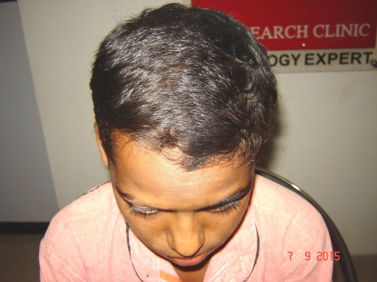 عيادة الدكتور راجغورو للعناية بالشعر - Dr. Rajguru Hair Care&Research Clinic