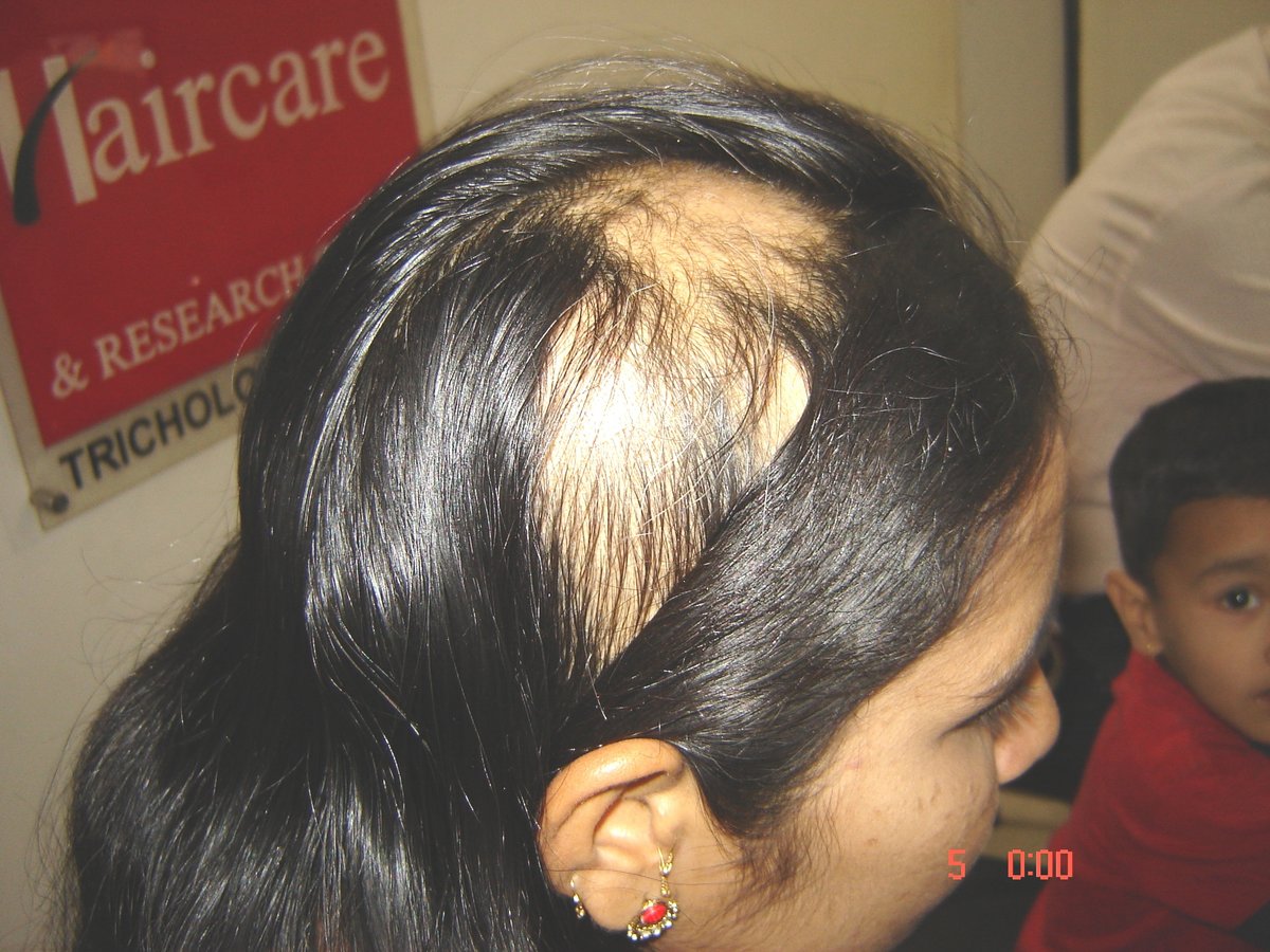 عيادة الدكتور راجغورو للعناية بالشعر - Dr. Rajguru Hair Care&Research Clinic