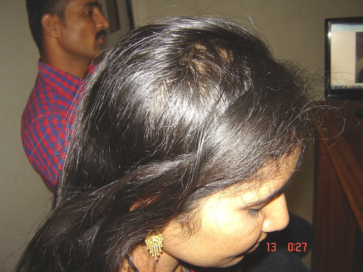 عيادة الدكتور راجغورو للعناية بالشعر - Dr. Rajguru Hair Care&Research Clinic