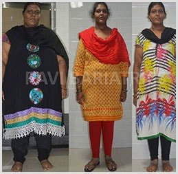 Dr. Ravi's Bariatric Surgery & Obesity Clinic - Dr. Ravi's Bariatric Surgery & Obesity Clinic