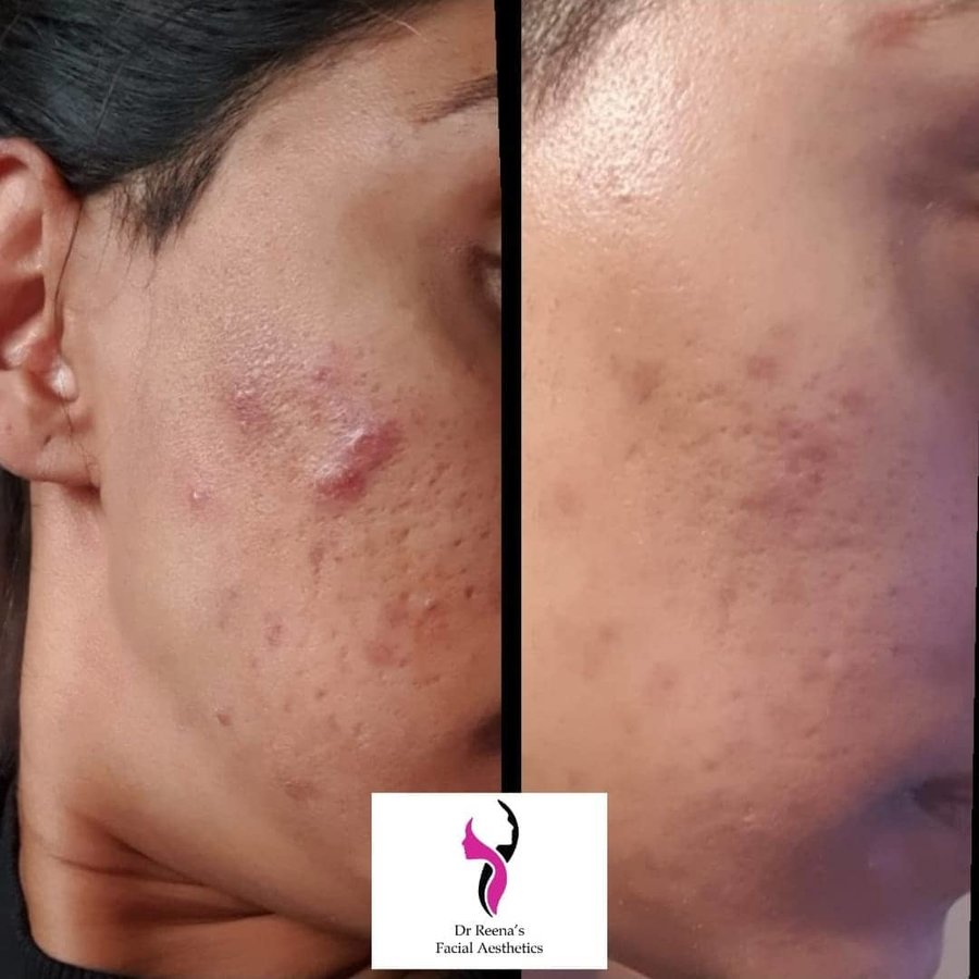 Dr Reena's Facial Aesthetics - Dr Reena's Facial Aesthetics